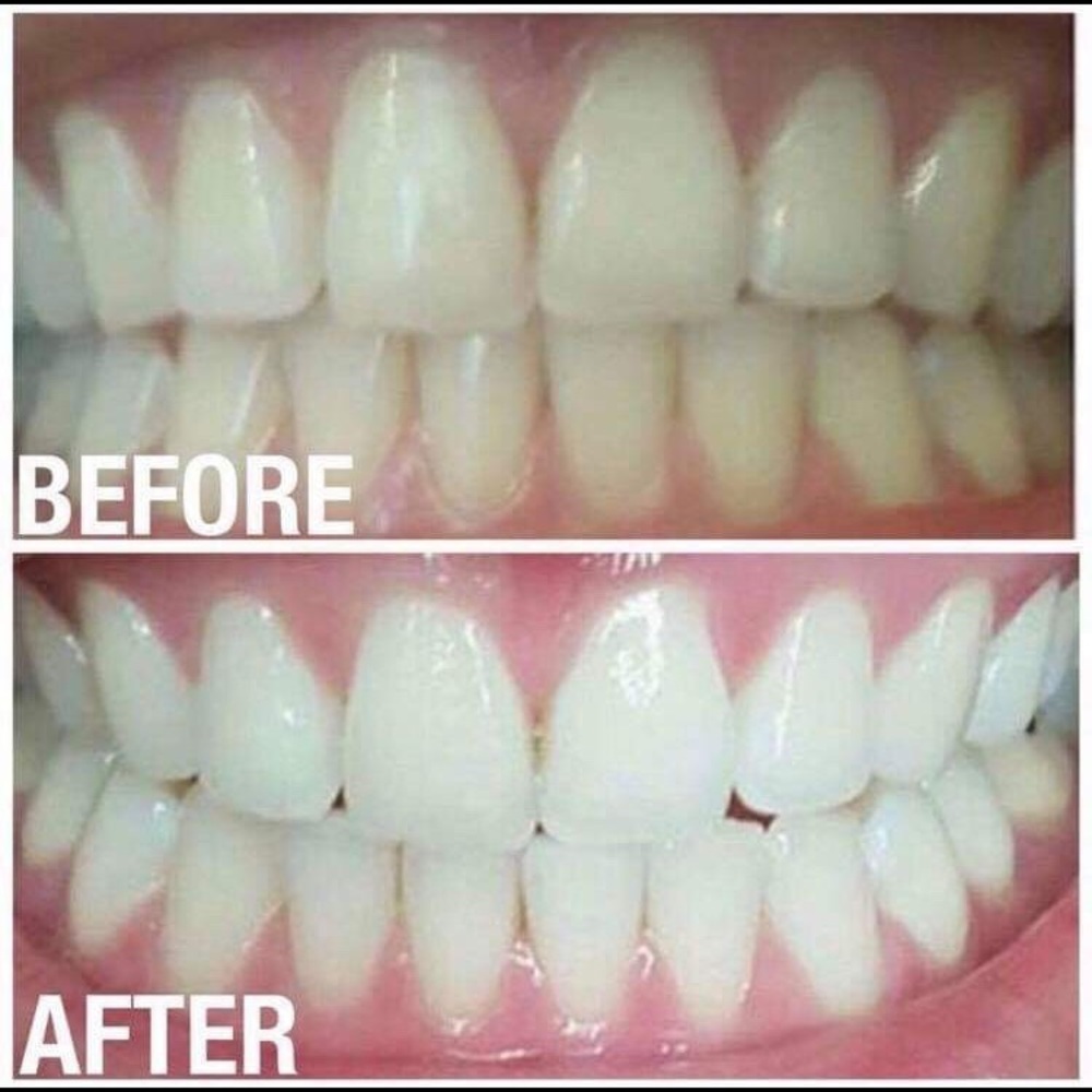 Tooth whitening paste